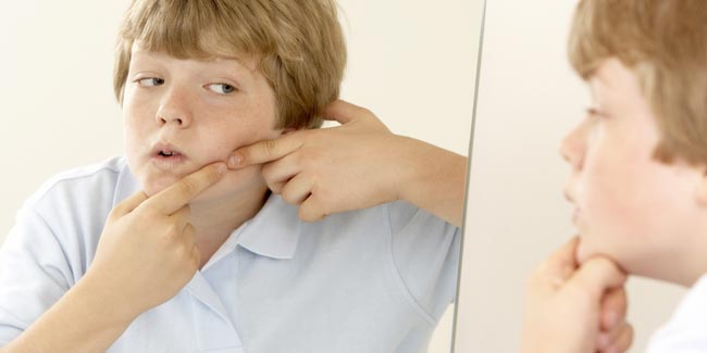 Acne: A Problem for Tweens and Younger Kids Too